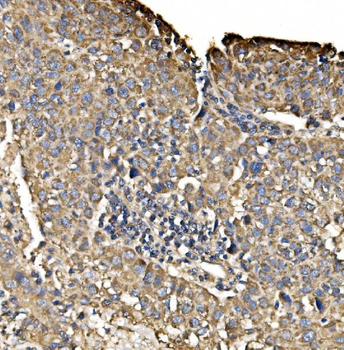 PIST/GOPC Rabbit Polyclonal Antibody