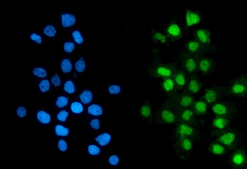 GTF2F2 Antibody