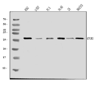 GTF2F2 Antibody