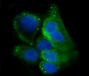 Glycogen synthase 1/GYS1 Antibody