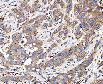 Glycogen synthase 1/GYS1 Antibody