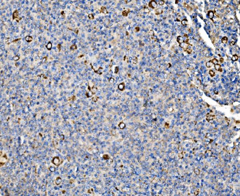 Glycogen synthase 1/GYS1 Antibody