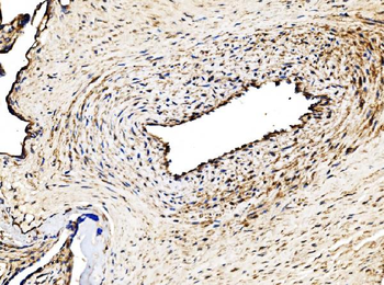 Glycogen synthase 1/GYS1 Antibody