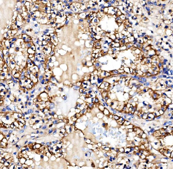 Glycogen synthase 1/GYS1 Antibody