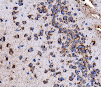 Glycogen synthase 1/GYS1 Antibody