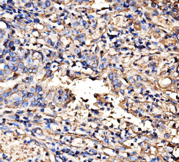 HECTD1 Antibody