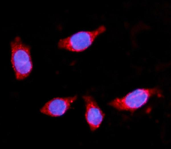 HMGCS2 Rabbit Polyclonal Antibody