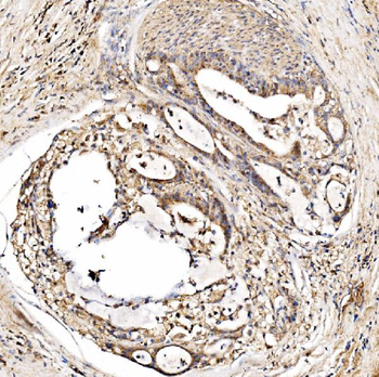 HMGCS2 Rabbit Polyclonal Antibody