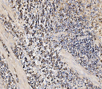 HMGCS2 Rabbit Polyclonal Antibody