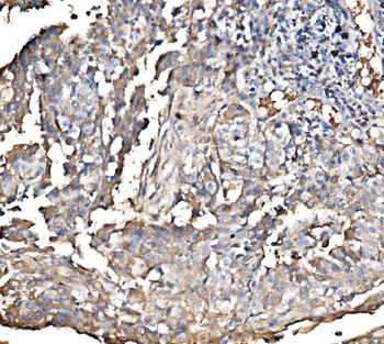 HMGCS2 Rabbit Polyclonal Antibody