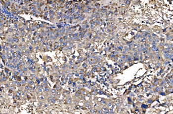 HMGCS2 Rabbit Polyclonal Antibody