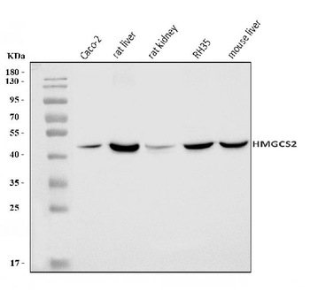 HMGCS2 Rabbit Polyclonal Antibody