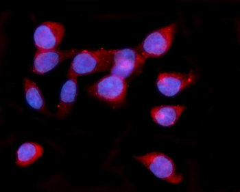 ORP150/HYOU1 Antibody