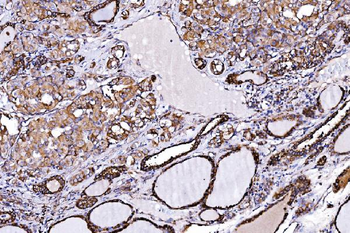 ORP150/HYOU1 Antibody