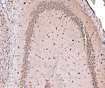 ORP150/HYOU1 Antibody