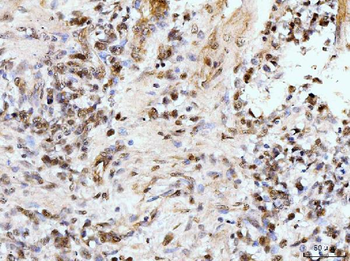 IFI16 Antibody