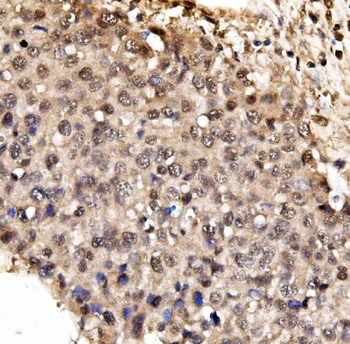 IFI16 Antibody