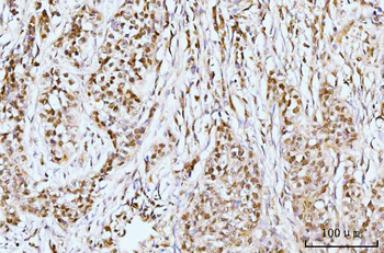 IFI16 Antibody