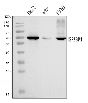 IMPI/IGF2BP1 Rabbit Polyclonal Antibody
