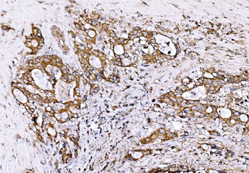 GPR54/KISS1R Antibody