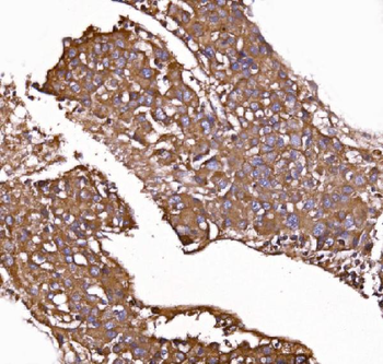 GPR54/KISS1R Antibody