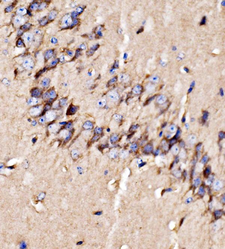 GPR54/KISS1R Antibody
