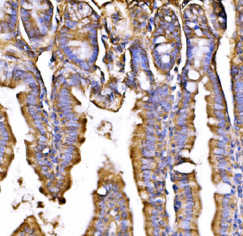 GPR54/KISS1R Antibody