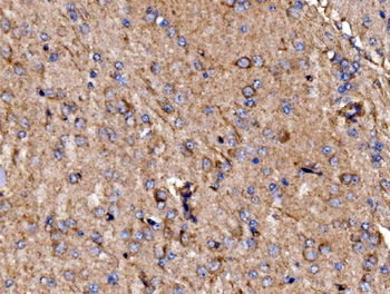 GPR54/KISS1R Antibody