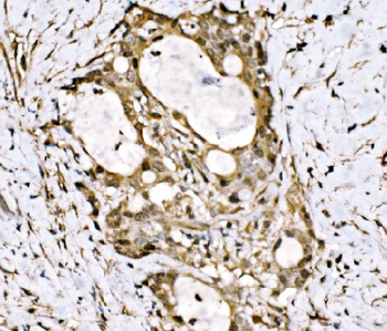 KLF15 Rabbit Polyclonal Antibody