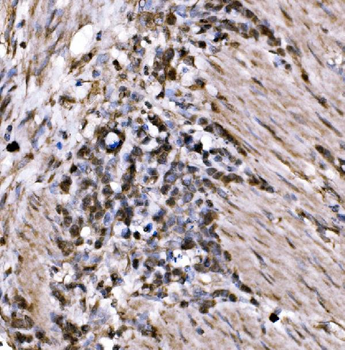 KLF15 Rabbit Polyclonal Antibody