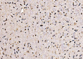 KLF15 Rabbit Polyclonal Antibody