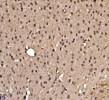 KLF15 Rabbit Polyclonal Antibody