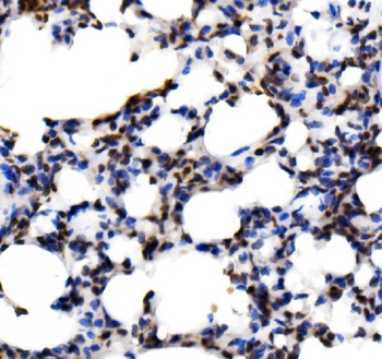 KLF15 Rabbit Polyclonal Antibody
