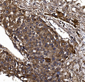KLHL12 Antibody