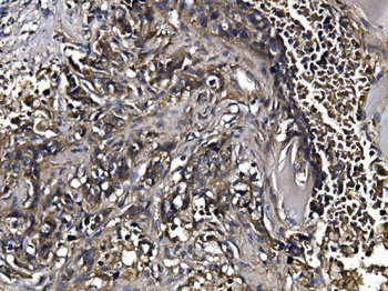 KLHL12 Antibody