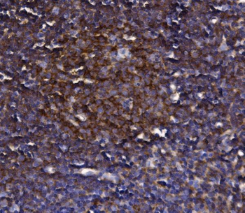 KLHL12 Antibody