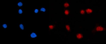 KPNB1 Rabbit Polyclonal Antibody