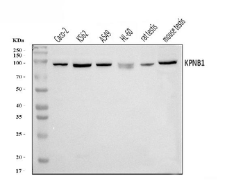 KPNB1 Rabbit Polyclonal Antibody