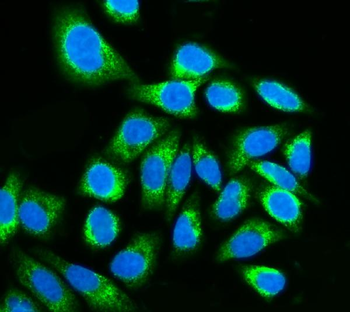 Kinectin 1/KTN1 Antibody