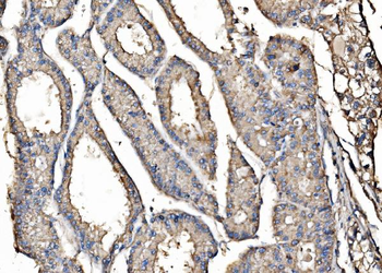Kinectin 1/KTN1 Antibody