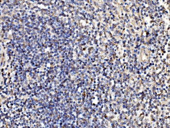 Kinectin 1/KTN1 Antibody