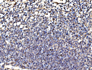 Kinectin 1/KTN1 Antibody