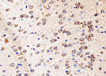 Kinectin 1/KTN1 Antibody