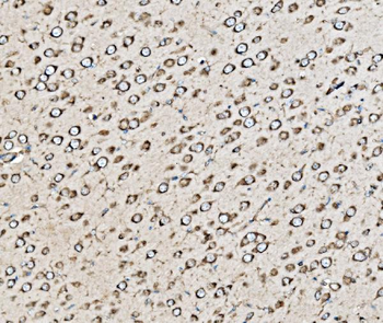 Kinectin 1/KTN1 Antibody