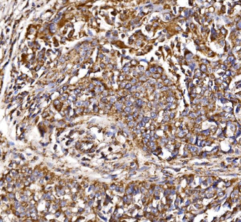 MDH2 Antibody