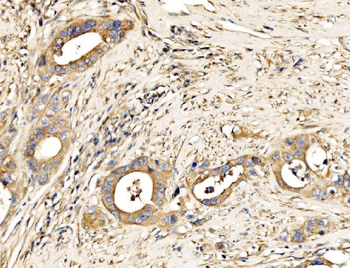 MLX-interacting protein/MLXIP Antibody
