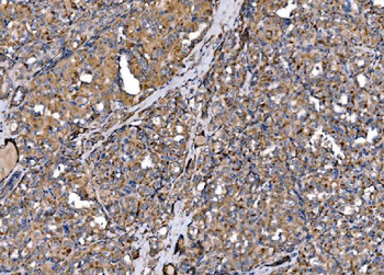 MLX-interacting protein/MLXIP Antibody