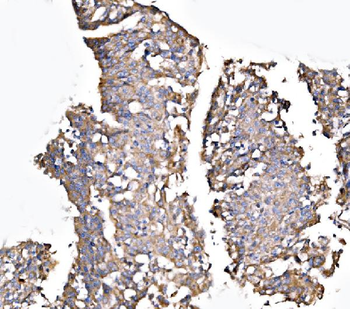 MLX-interacting protein/MLXIP Antibody