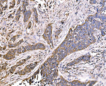 MLX-interacting protein/MLXIP Antibody