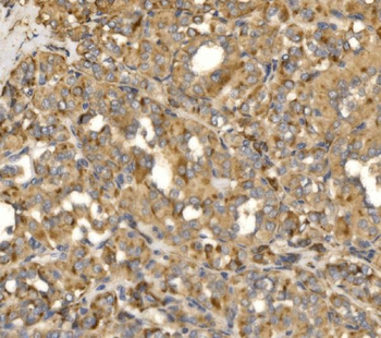 MLX-interacting protein/MLXIP Antibody
